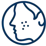 Acne Treatment Preparations